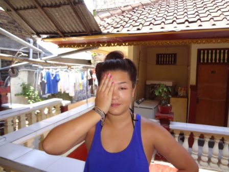 2. gestochenes Auge...