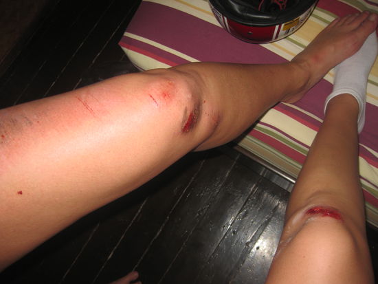 Nachher....in Echt sieht es noch vieeeeel schlimmer aus....schnieeeef