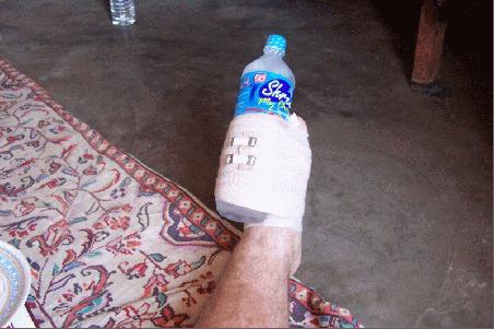 fußkühlung - alternativ mit gefrorener wasserflasche.