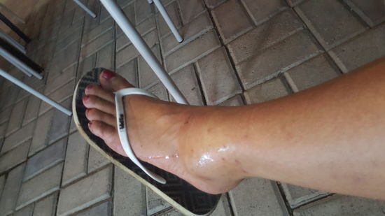 Ooohhh.....schitt....auf dem Weg von Gambit-Station bin ich gestürzt und habe mir mächtig den Knöchel verrenkt.