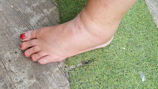 Ganz egal was man mitnimmt, irgendwas fehlt immer. Diesmal Voltaren..