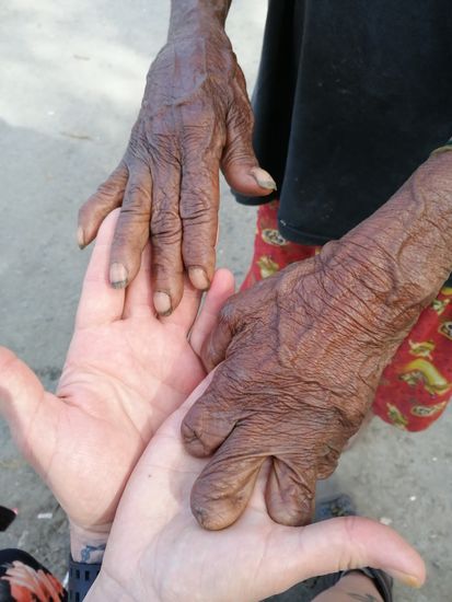 ...und fotografieren.....die Hände und überhaupt die ganze Haut ist sehr weich und faltig. Ganz merkwürdig..
