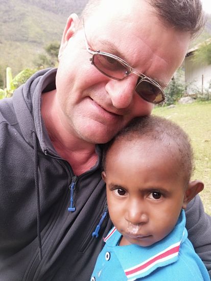 Fast alle Kinder haben eine „Rotznase“