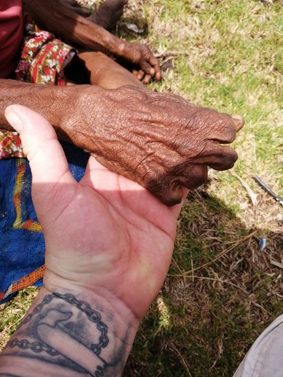 Und—sie hat viele junge Familienangehörige verloren...