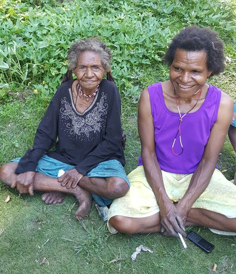 Hier sieht man deutlich, dass jeder Finger amputiert ist