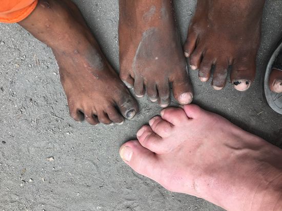 Wieder fällt uns auf, wie breit die Füße der Kinder hier sind. Das kommt wohl vom Barfußlaufen