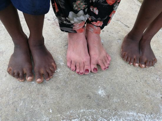 Fußvergleich...meine haben schon etwas gelitten...