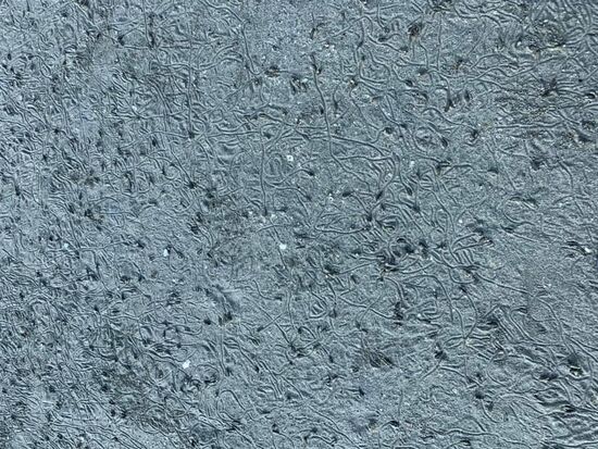 Millionen von Schnecken....