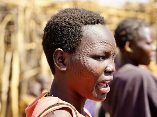Diese Frau hat sehr viele Narben im Gesicht. Die Narben sind ein Gesichtsschmuck. Je mehr sie hat, desto hübscher und „wertvoller“ ist sie. Die Narben werden mittels eines Dorns von einem bestimmten Baum in die Haut gebracht. Der Dorn wird unter die Haut geschoben und dann wir die Haut abgezogen. Das gibt eine offene Wunde, die mit dem Urin der Kühe betupft wird. Das ist sehr schmerzhaft. Es dauert einige Zeit, bis die Narbe verheilt. Manche Frauen fügen sich viele dieser Narben zu. Sie will hübsch sein und wertvoll für die Hochzeit.