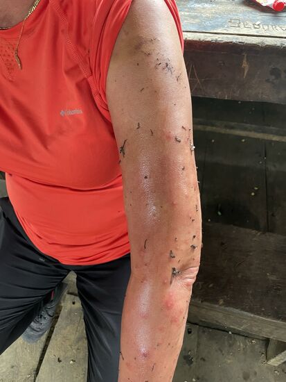 Ob das wohl hilft??Sie rätseln, was mich da wohl gestochen hat…