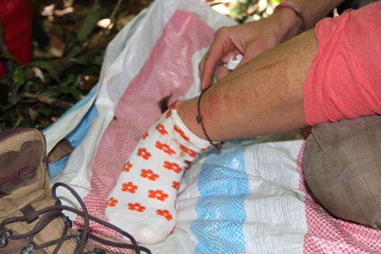 da halfen auch die hochmodernen Socken nicht, ihih Blutegel...